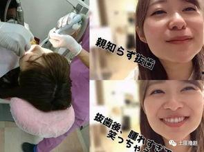 女明星拔牙视频,勇敢面对美丽挑战